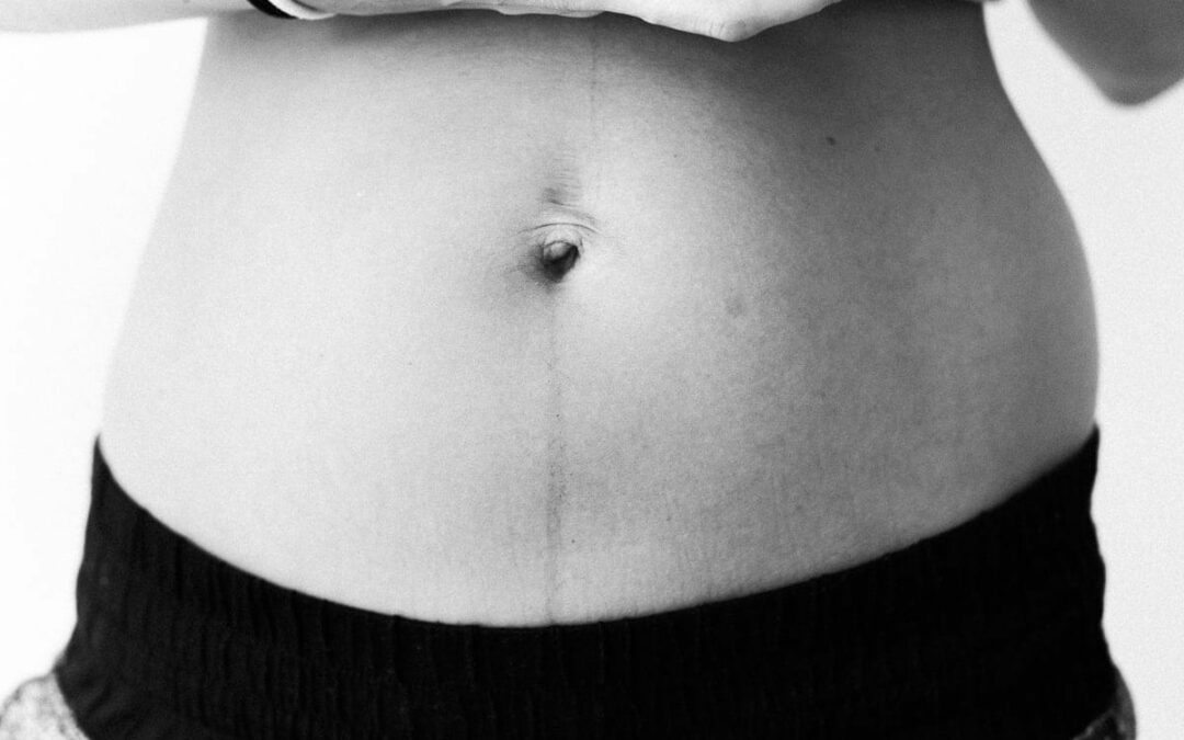 El puerperio: hágase la luz