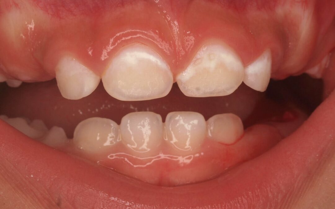 Mi hijo no se deja lavar los dientes: ¿cuándo y cómo empezar a cepillar los dientes del bebé?